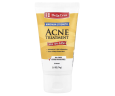 Мазь для лікування акне з 10% сіркою De La Cruz (Acne treatment ointment with 10 sulfur) 74 г